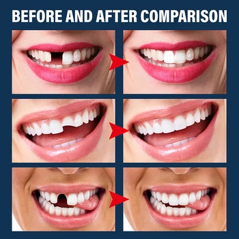 Dinte temporar de Reparare Margele Lipsesc Dinti Rupte Dentare Dinte Material de Umplutură de Calitate Alimentară FalseTeeth Lipici Solid Proteza 30ML