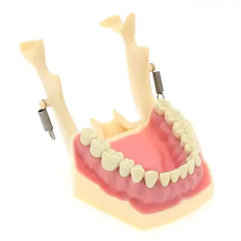Typodont Standard Dentare Modelul de 32 de Îndepărtat Dinți Tehnician Practică Studierea Demonstrație de Mestecat Compatibil Cu Frasaco AG3